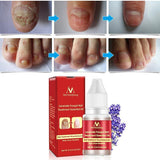 New Chinese Cream Nails Finger Toe Protector Fungus Treatment Herb Health Tools Onychomycosis