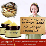 Herb acne cream control pox light printing moisturizing oil removal acne acne pit