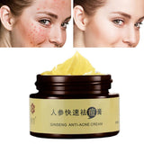 Herb acne cream control pox light printing moisturizing oil removal acne acne pit