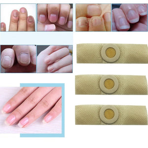 Best Chinese Medicine Herbs Nail Treatment Cream Paronychia Anti Nail Infection Fights Bacteria